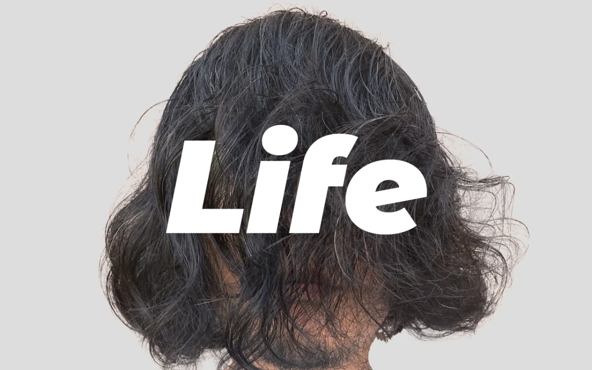 【⚠️閲覧注意⚠️】お尻が痛い。